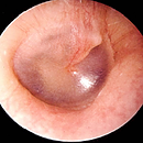 Otoscopy Adult- Part-Task Trainer (AuD) Profile Pic